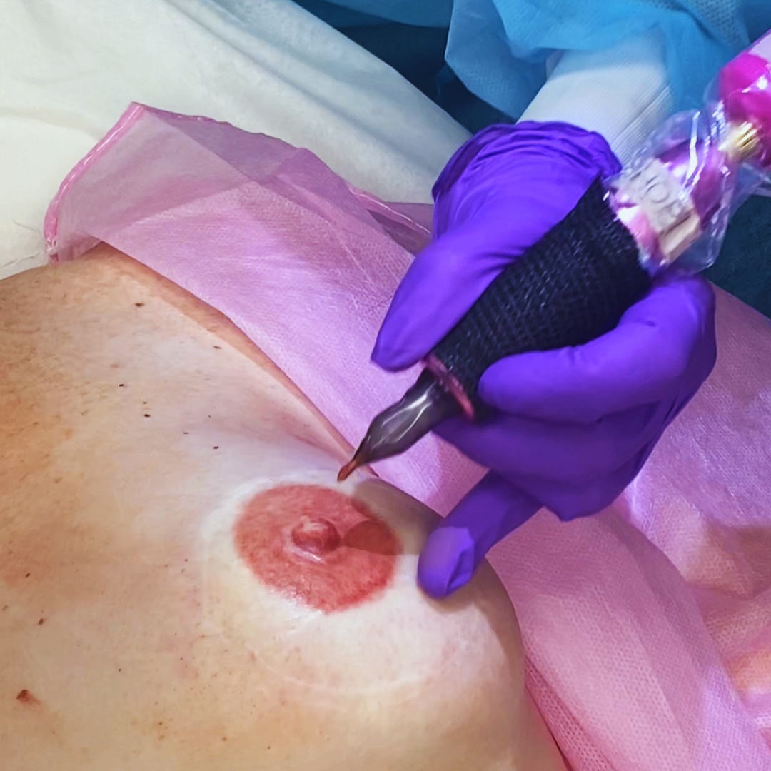 3D Areola & Intro to Scar Camouflage - June 2025